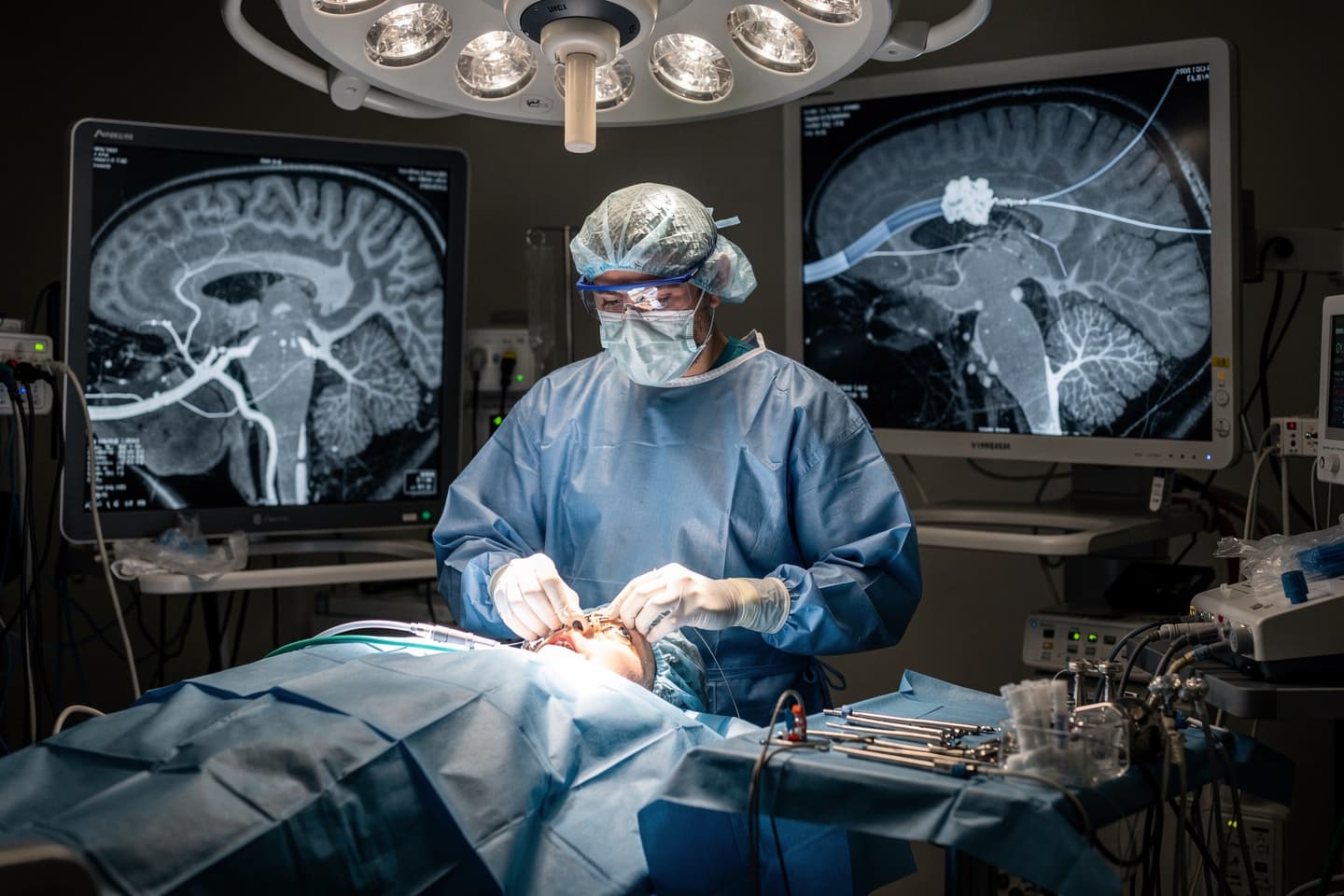 Trombectomia în ocluzia vaselor cerebrale medii — rezultate din NEJM